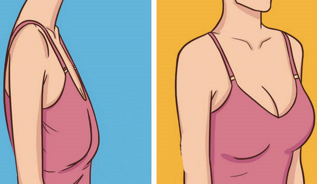 Подтянуть обвисшую грудь девушке: упражнения, бюстгальтер и другие способы