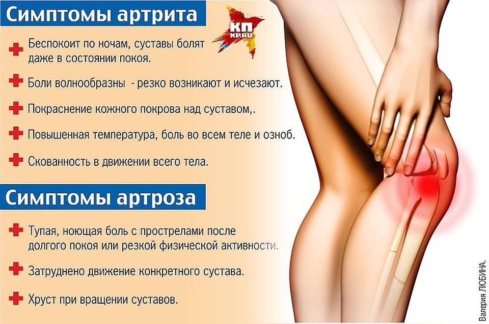 Артроз суставов (остеоартроз): причины, симптомы и лечение - travmasport
