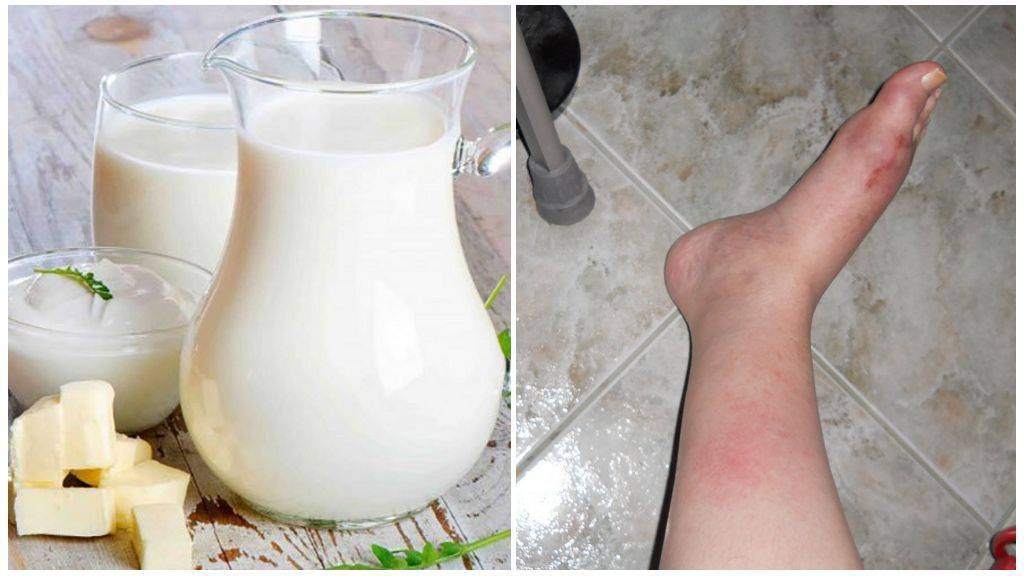 Можно ли пить молоко и есть творог при похудении: молочка и кефир на диете. отеки: задерживают ли молочные продукты воду в организме?