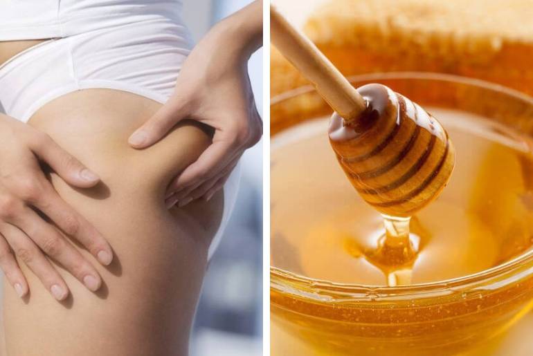 Антицеллюлитный массаж живота с медом для похудения. как делать массаж дома
