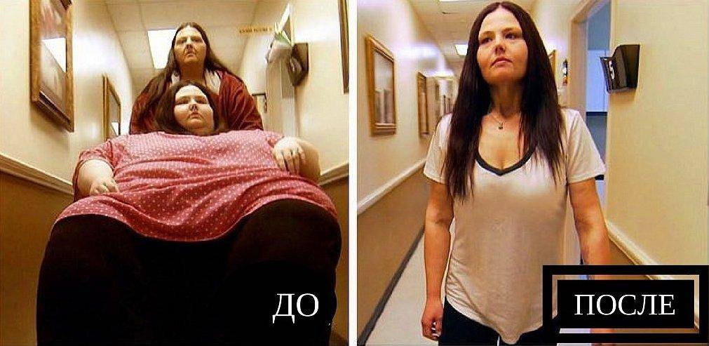 «я вешу 300 кг: что было дальше» — 5 драматических историй похудения с фото до и после