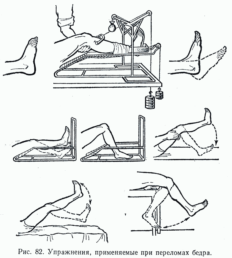 Массаж для ног после перелома колена, лодыжки и берцовой кости