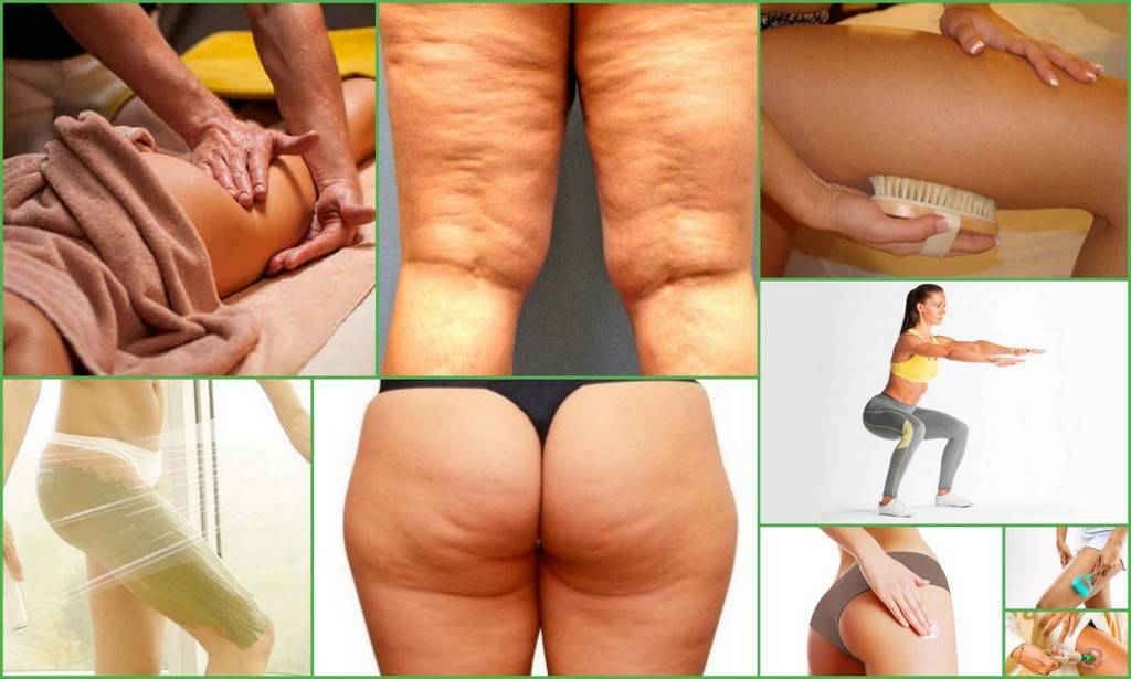 Работающие способы подтянуть кожу после похудения: физическая культура, питание, косметологические процедуры