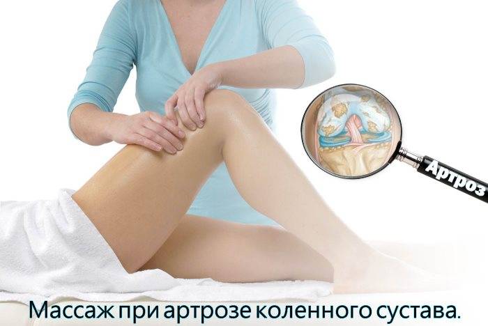Гонартроз коленного сустава 2 степени: лечение в москве