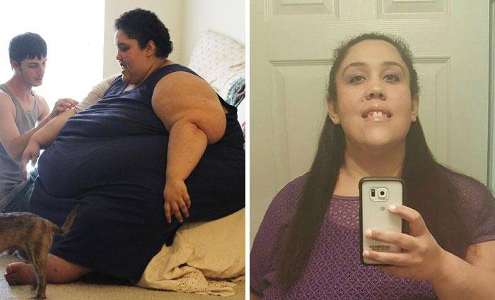 «Я вешу 300 кг: что было дальше» — 5 драматических историй похудения с фото до и после