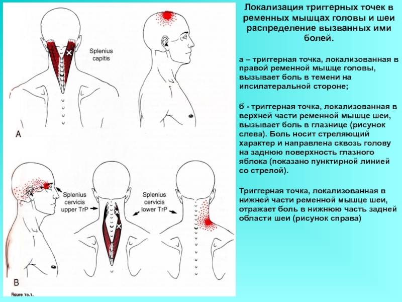 Болит шея: продуло, или боль в шее имеет другую причину? лечение боли в шее