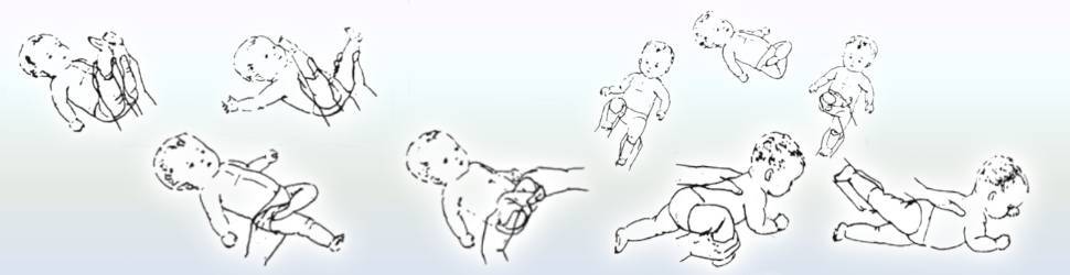 Дисплазия тазобедренных суставов - формы, симптомы, диагностика и лечение | детская ортопедия см-клиники в спб