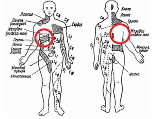 Боль в спине под левой лопаткой - причины, виды боли, лечение