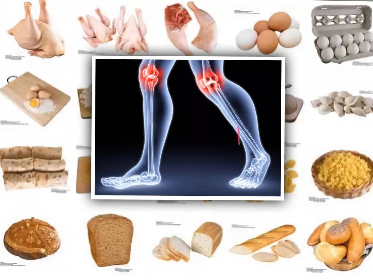 Артроз суставов ️: симптомы, причины, диагностика и лечение