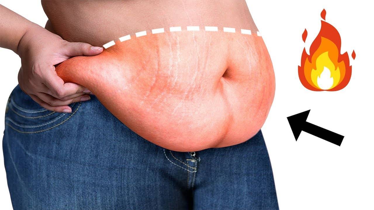 Подкожный жир у мужчин и женщин, как убрать, диета