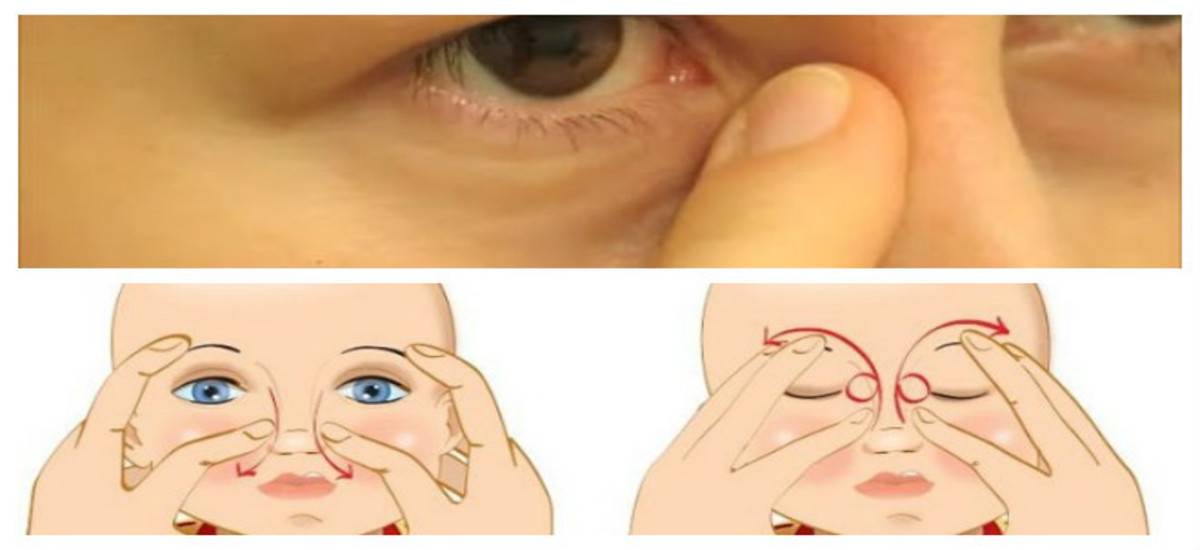Техника массажа слезного канала у новорожденных при дакриоцистите с видео-инструкцией от доктора комаровского