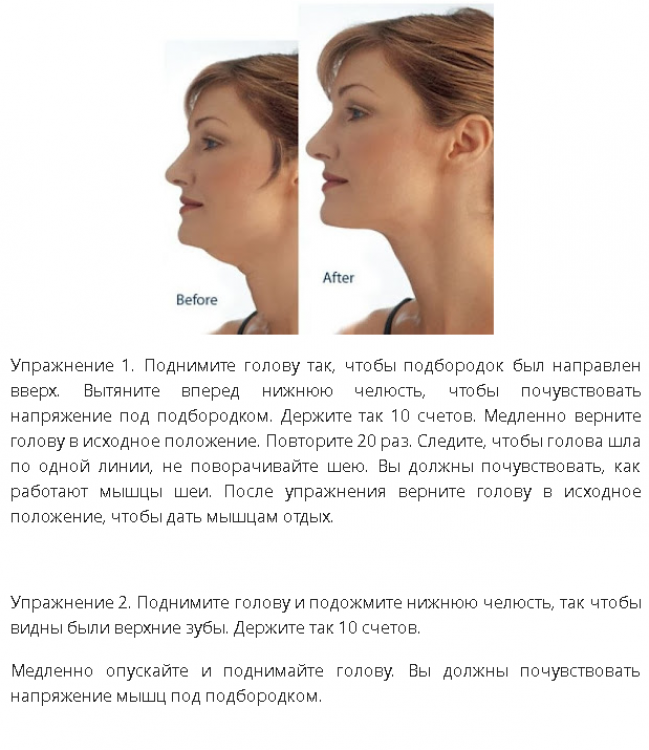 Коррекция второго подбородка в клинике косметологии «градиент» в москве
