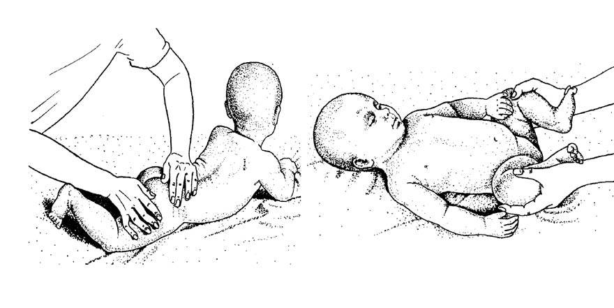 Массаж при вальгусной деформации стопы у детей