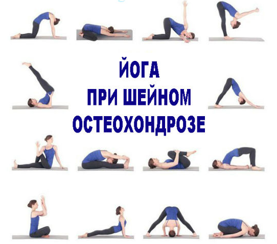 Простые упражнения при остеохондрозе