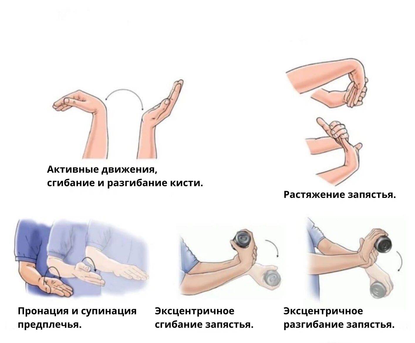 Как разработать локтевой сустав после перелома