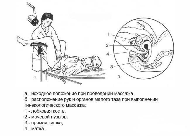 Гинекологический массаж матки