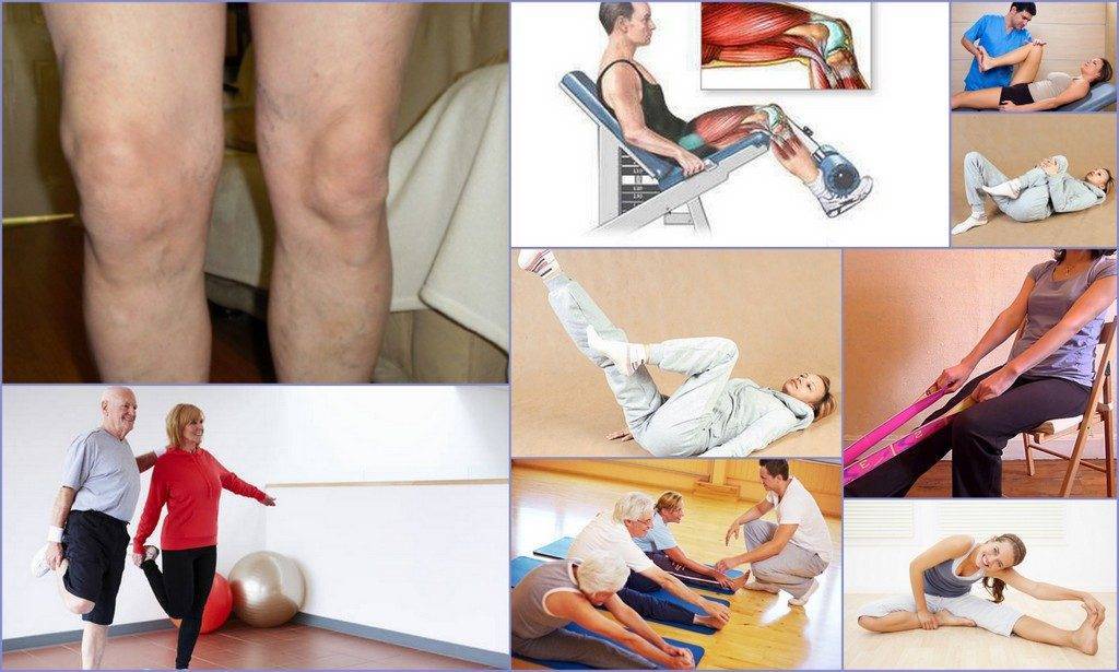 Лечение связок и суставов: устранение симптомов, методы лечения