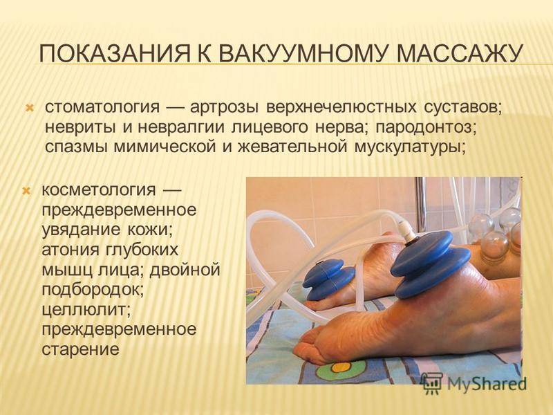 Антицеллюлитный массаж: руки или вакуум? | портал 1nep.ru